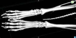 Knochen Pfote CT 3D Hund 